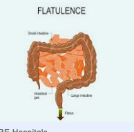 Image of Flatulence