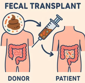 Fecal Microbial Transplant