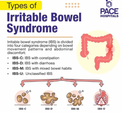 Image of IBS
